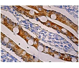 immunohistochemistry image from recommended sEH (A-5) monoclonal antibody replacement. Image 159611