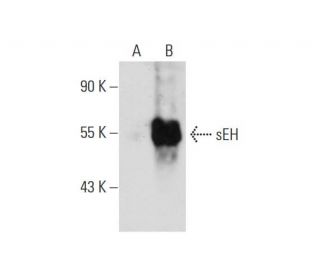sEH Antibody (A-5) - Western Blotting - Image 127817Each CRISPR/Cas9 Knockout (KO) Plasmid product consists of a pool of 3 plasmids designed to ensure identification and cleavage of a specific gene for maximum knockout efficiency. Each plasmid encodes a unique 20 nt sequence derived from the GeCKO (v2) library. 