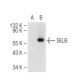 SELB Antibody (G-9) - Western Blotting - Image 84040