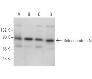 Selenoprotein N Antibody (A-11) - Western Blotting - Image 376547 