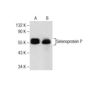 Selenoprotein P Antibody (B-9) | SCBT - Santa Cruz Biotechnology