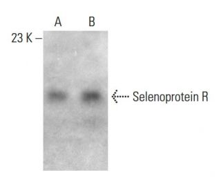 Selenoprotein R Antibody (QA-V7) - Western Blotting - Image 385135 