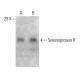 Selenoprotein R Antibody (QA-V7) - Western Blotting - Image 385135 
