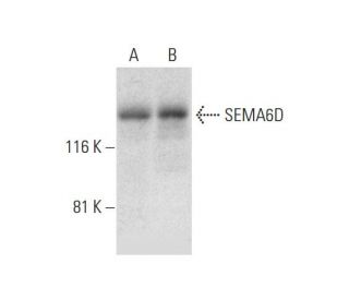 SEMA6D Antibody (A-8) - Western Blotting - Image 294408 