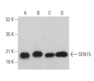 SEN15 Antibody (D-3) - Western Blotting - Image 369041 