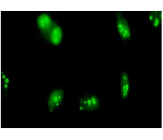 SENP5 Antibody (3C2) - Immunofluorescence - Image 346157 