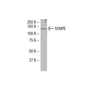 SENP6 Antibody (79-M) - Western Blotting - Image 33958 