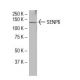 SENP6 Antibody (79-M) - Western Blotting - Image 33958 