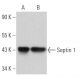 Septin 1 Antibody (B-8) - Western Blotting - Image 366211