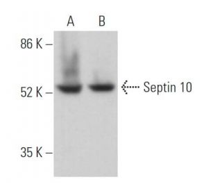 Septin 10 Antibody (C-3) - Western Blotting - Image 371317 