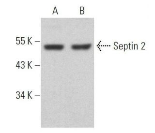 western blotting image from recommended Septin 2 (F-1) monoclonal antibody replacement. Image 359084
