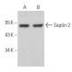 western blotting image from recommended Septin 2 (F-1) monoclonal antibody replacement. Image 359084