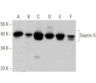 western blotting image from recommended Septin 5 (SP18) monoclonal antibody replacement. Image 359540