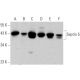 This polyclonal antibody has been discontinued. See our recommended <a href="septin-5-antibody-sp18">Septin 5 (SP18)</a> monoclonal antibody (sample data shown). western blotting image from recommended Septin 5 (SP18) monoclonal antibody replacement. Image 359540