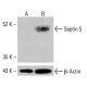 Septin-5-Antikörper (H-7): sc-390729. Western-Blot-Analyse der Septin-5-Expression in unbehandelten (A) und chemisch behandelten (B) K-562-Zelllysaten. β-Actin (C4): sc-47778 als Ladekontrolle verwendet. Verwendetes Nachweisreagenz: m-IgG Fc BP-HRP: sc-525409. Septin 5 Antibody (H-7) - Western Blotting - Image 415134
