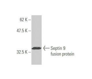 Septin 9 Antibody (2C6) - Western Blotting - Image 349034
