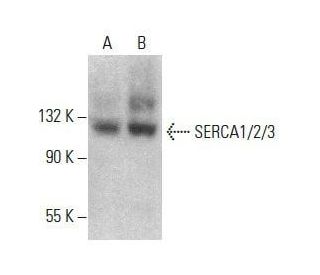 SERCA1/2/3 Antibody (B-7) - Western Blotting - Image 354040 