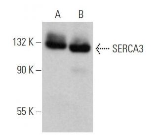 western blotting image from recommended SERCA3 (PL/IM430) monoclonal antibody replacement. Image 362854