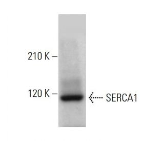 SERCA1 Antibody (4i352) - Western Blotting - Image 379193 