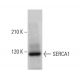 SERCA1 Antibody (4i352) - Western Blotting - Image 379193 