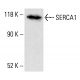 SERCA1 Antibody (4i352) - Western Blotting - Image 413319