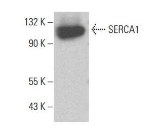 SERCA1 Antibody (4i390) - Western Blotting - Image 380416