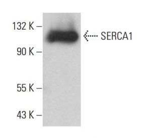 SERCA1 Antibody (6D138) - Western Blotting - Image 380414