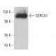 SERCA1 Antibody (6D138) - Western Blotting - Image 380414
