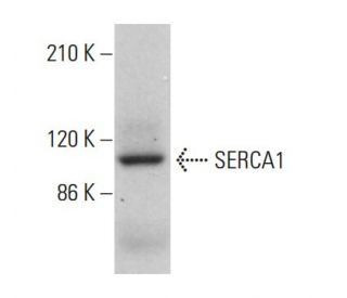 SERCA1 Antibody (6D139) - Western Blotting - Image 379191 