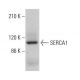 SERCA1 Antibody (6D139) - Western Blotting - Image 379191 
