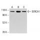 SERCA1 Antibody (6D139) - Western Blotting - Image 413320