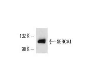 SERCA1 Antibody (IIH11) - Western Blotting - Image 13606 