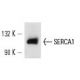 SERCA1 Antibody (IIH11) - Western Blotting - Image 13606 