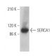 SERCA1 Antibody (IIH11) - Western Blotting - Image 362947