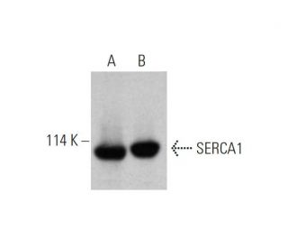 western blotting image from recommended SERCA1 (A-6) monoclonal antibody replacement. Image 344286