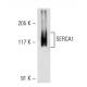 SERCA1 Antibody (VE121G9) - Western Blotting - Image 19274