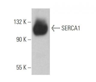 SERCA1 Antibody (VE121G9) - Western Blotting - Image 360179 