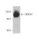 SERCA1 Antibody (VE121G9) - Western Blotting - Image 360179 