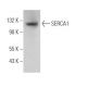 SERCA1 Antibody (VE121G9) - Western Blotting - Image 371516 
