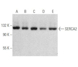 SERCA2 Antibody (IID8) - Western Blotting - Image 354048 