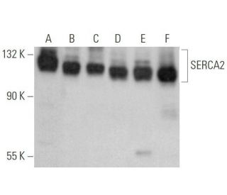 western blotting image from recommended SERCA2 (F-1) monoclonal antibody replacement. Image 352702