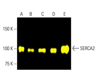 SERCA2 Antibody (IID8) - Western Blotting - Image 402219