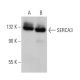 Este anticuerpo policlonal ha dejado de fabricarse. Consulta nuestro anticuerpo monoclonal recomendado <a href="serca3-antibody-pl-im430">SERCA3 (PL/IM430)</a> (se muestran datos de muestra). western blotting image from recommended SERCA3 (PL/IM430) monoclonal antibody replacement. Image 362854