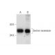 western blotting image from recommended Serine racemase (A-4) monoclonal antibody replacement. Image 138507