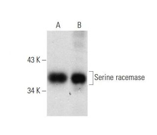 western blotting image from recommended Serine racemase (A-4) monoclonal antibody replacement. Image 138507