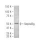 SerpinA3g Antibody (MoFo29.2) - Western Blotting - Image 67400