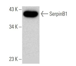 SerpinB1 Antibody (4D7) - Western Blotting - Image 368196The Double Nickase Plasmid features a U6 promoter for sgRNA expression, a 20 nt targeting sequence, and a gRNA scaffold to guide Cas9n. It includes a CBh promoter for Cas9n (D10A) and puromycin resistance, GFP for transfection verification, and nuclear localization signals (NLS). The 2A peptide allows co-expression of Cas9n and Puro from a single promoter, enabling precise genome editing with reduced off-target effects.