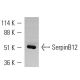 SerpinB12 Antibody (H3-1B) - Western Blotting - Image 9228