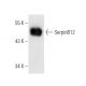 SerpinB12 Antibody (H3-1B) - Western Blotting - Image 9885 