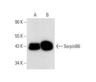 SerpinB6 Antibody (E-8) - Western Blotting - Image 304993